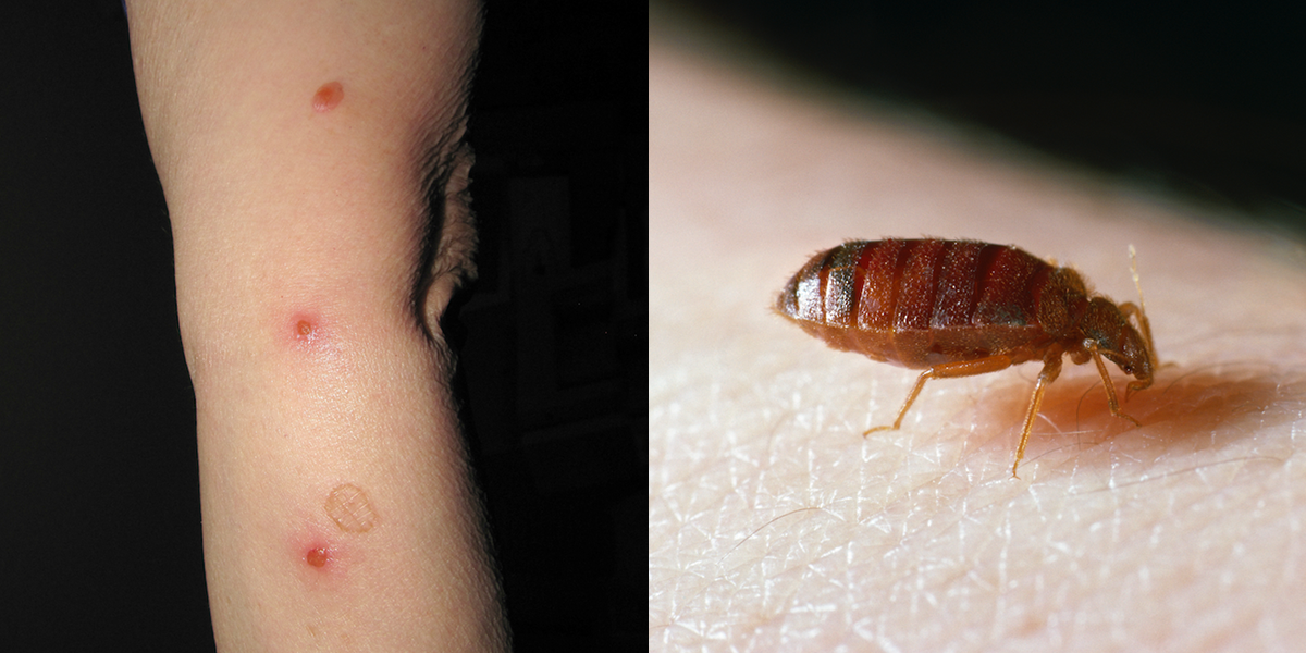 Orlando Bed Bug Exterminator